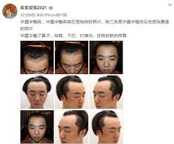 歌手 當打之年 華晨宇 斗牛 登云音樂榜首 為何可以蟬聯 歌手 的第一 娛樂圈圈圈. Vyl4mep1elye0m