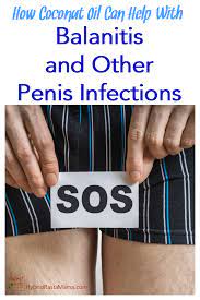 If you have balanitis, you might notice don't use force, especially in toddlers. Coconut Oil For Balanitis And Other Penile Infections Hybrid Rasta Mama