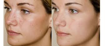 Résultat de recherche d'images pour "Glycolic acid"