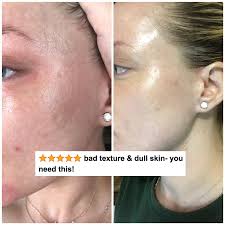 How to get rid of textured skin on face. 23 Products Designed To Help You Get A More Even Skin Tone