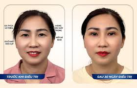 Hành trình trẻ hóa đôi mắt, lấy lại sự tự tin cho người mẹ hai con