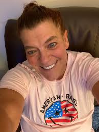 Does dog exercise burn calories?