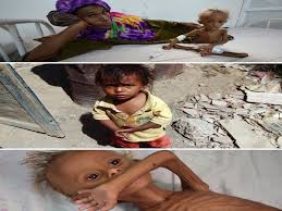 Projects Aid For Yemen Launchgood What is launchgood and what makes it different than any other crowdfunding website? projects aid for yemen launchgood