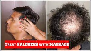 Fusco suggests adding a hair oil to your dry scalp massage to help hydrate your hair and soothe your scalp. à¤¸ à¤° à¤• à¤šà¤® à¤ª à¤• à¤¸ à¤•à¤° Head Massage Techniques For Hair Growth Sushmita S Diaries Hindi Youtube