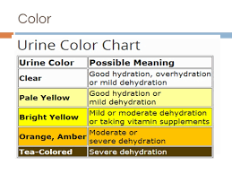 urine analysis pptx