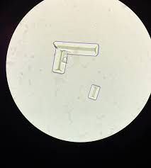 Hepatita b este o boala infectioasa determinata de virusul hepatitei b (vhb), un virus adn a carui gazda naturala este omul. Examen Complet De Urina Sumar Si Sediment Laboratoarele Sfanta Maria