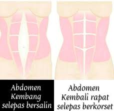 Lakukan proses ini hingga seluruh kawasan rahim. Tanda Rahim Kembang 1 Bump Push Up Pants Sara Anna Facebook