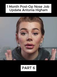 Antonia Higham Before and After