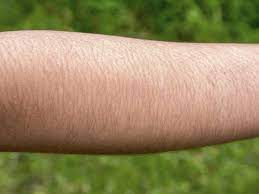 Summer is a time for light dresses, tank tops, shorts, and of course, bikinis. How To Get Rid Of Arm Hair Getridofthings Com
