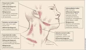 They are part of the lymph system, which is a component of swelling is most noticeable in the neck, the armpits, and the groin, where there are clusters of nodes. Unexplained Lymphadenopathy Evaluation And Differential Diagnosis American Family Physician