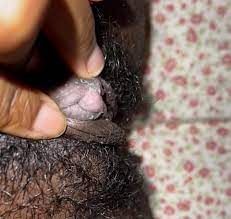 Smelly smegma filled clit. Can you lick it for me? | Scrolller
