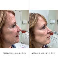 SB Medical Aesthetics, 23 Clara Dr, Ste 105, Mystic, CT 06355, US