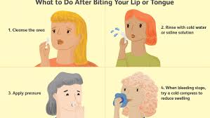 Using lip balm can be considered as a tremendous natural home remedy for swollen lip. What To Do When You Bite Your Lip Or Tongue