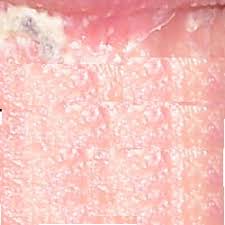 How to get rid of ants cheaply and naturally 2. Talk Smegma Wikiwand