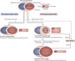 Mechanisms Of Physiological And Pathological Cardiac Hypertrophy Nature Reviews Cardiology