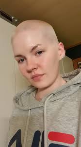 Here's my before and after picture. I'm an albino FYI if you couldn't tell  lmao. My hair is all natural platinum!