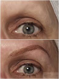 permanent makeup micropigmentation