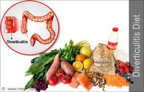 Maybe you would like to learn more about one of these? 17 Diverticulitis Ideas Diverticulitis Diverticulitis Diet Diverticulitis Recipes