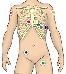 An ekg can be used to further investigate symptoms related to heart problems. Elektrokardiogramm Wikipedia