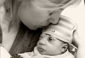 Remembering Grayson: Anencephalic Baby Facebook Banned Whose Life Impacted  so Many