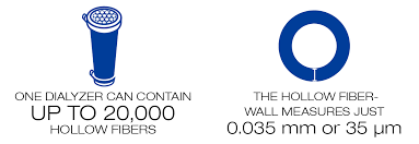 Progress in dialysis led to shorter time, about 4 hours. Understanding Dialysis Fresenius Medical Care