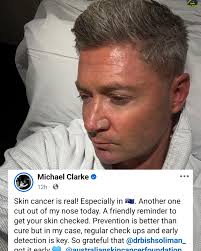 Australian captain battles skin cancer