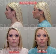 Read this post on how to. Tmj Success Story With Arwen Smile Doctor Randi Green Dmd Lvif