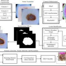 Men are more likely to develop melanomas on their back, trunk. Abcdes Of Melanoma Ii Related Work Download Scientific Diagram
