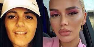 Loredana ungeschminkt | kmn zuna schminkt loredana. Loredana Ohne Instagram Filter Ist Sie Nicht Wiederzuerkennen