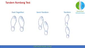 Image result for Romberg Test