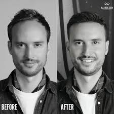 THE BEST 10 HAIR LOSS CENTERS in PALM COAST, FL