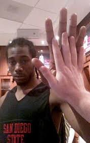 Kawhi leonard isn't the only player with enormous hands to grace the league. Jeff Passan Ar Twitter This Is Kawhi Leonard S Hand In 2011 This Is Mcconeghysdsu S Two Full Knuckles Bigger This Is Not Photoshopped Http T Co Dyayzbc90r