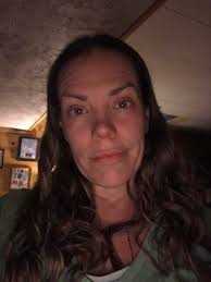 Dog bite wound recovery and exercise concerns