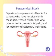 Image result for Paracervical Block