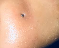 Is My Nose Piercing Ring Is Sinking In