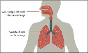 Patients and families can hire a mesothelioma attorney who will help them access the funds they need to cover medical costs, lost wages and other. What Causes Mesothelioma Other Than Asbestos Rosemary Salmon Lemon Rosemary Salmon Lemon Rosemary