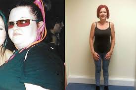 Vážila bezmála metrák a půl. Dnes má 60 kilo, ale zadarmo to nebylo!  Operace žaludku ji stály jmění