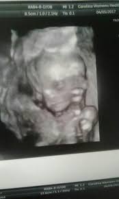 5 weeks 6 days posted by: 16 Weeks 6 Days Baby 4 And 1st Girl Glow Community