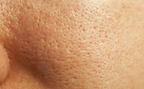 মুখের খোলা লোমকূপ? ঘরোয়া এই দুই উপায়েই করুন দূর, মেয়েরা জেনেনিন