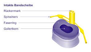 Gelenklehre > joints of spine, thorax and skull > zwischenwirbelsymphyse > bandscheibe > gallertkern. Nucleus Pulposus Gelenk Klinik De