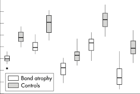 Box Plot Chart Showing The Distribution Of Retinal Nerve