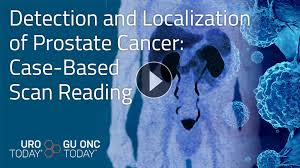 There is no single test to detect prostate cancer. Detection And Localization Of Prostate Cancer Case Based Scan Reading Review Videos
