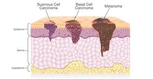 Check spelling or type a new query. Basal Cell The Definitive Guide Biology Dictionary