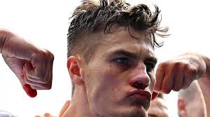 Euro : Le but de Patrik Schick le nez en sang fait le tour de la Toile