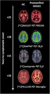 Aug 15, 2018 · huntington's disease is a hereditary condition in which your brain's nerve cells gradually break down. Frontiers Molecular Imaging Markers To Track Huntington S Disease Pathology Neurology