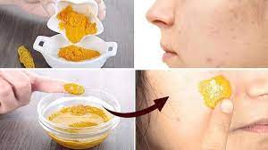 Biarkan masker ini selama setidaknya 20 menit sebelum dibilas. 3 Cara Ampuh Hilangkan Bekas Jerawat Dengan Kunyit Bahan Bahan Mudah Ditemukan Murah Meriah Surya