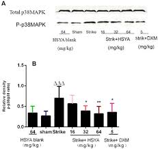 Soft tissue injuries refers to a class of injuries that does not include hard tissue (bone) but can be from either acute trauma or from overuse. Hydroxysafflor Yellow A Attenuates The Expression Of Inflammatory Cytokines In Acute Soft Tissue Injury Scientific Reports