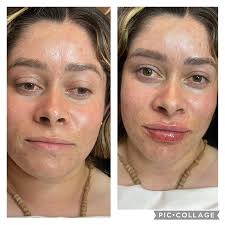 Dra. Paulina Estrada R. (@dra.paulinaestradar) • Instagram photos and videos