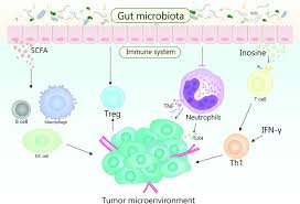 Lalu bagaimana nomor wa kita supaya di save oleh gus azmi ? Exploring The Emerging Role Of The Gut Microbiota And Tumor Microenvironment In Cancer Immunotherapy Abstract Europe Pmc