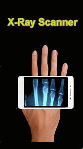 Xray really have to put your hand under and see radiographed. X Ray Scanner For Android Apk Download